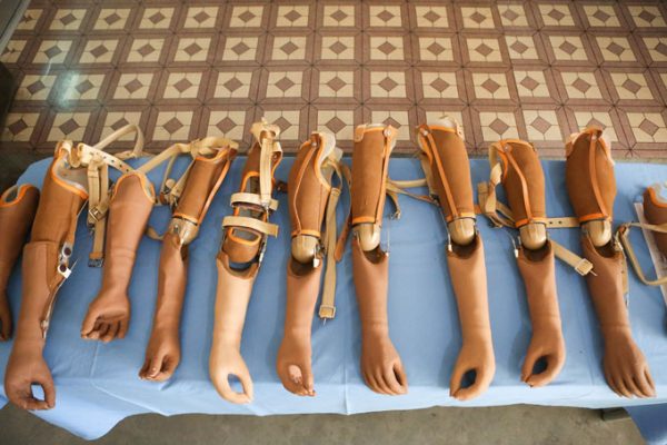 Prosthetic limbs for Rana Plaza survivors