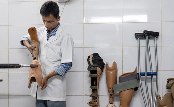 Artificial limbs change lives: Here’s how we can scale them up in low-income countries